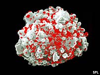 célula infectada por el virus del sida